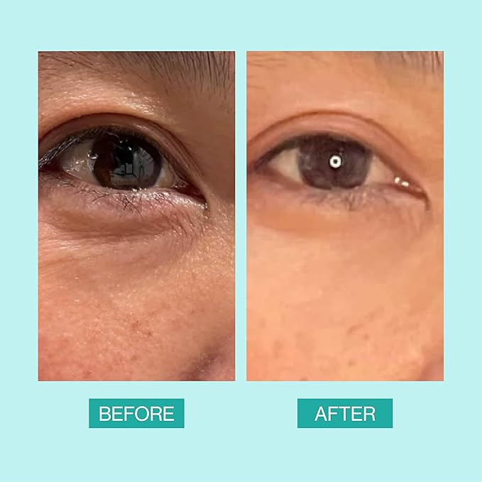 eb5 Daily Repair Eye Treatment | Under Eye Cream for Dark Circles and Puffiness | Anti-Aging Eye Cream with Peptides for Women and Men - 0.50oz-VivaGrace Women