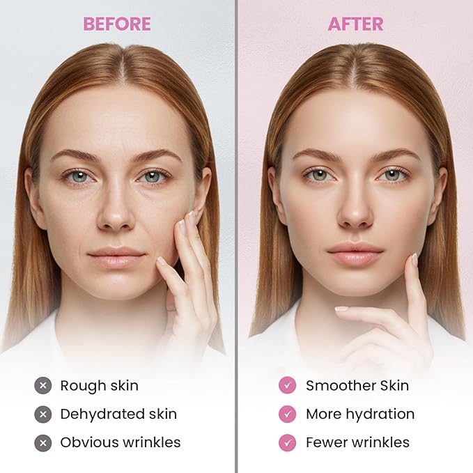 New Anti Facial Wrinkle Patches: Anti Wrinkle Patches Overnight - Smile Line Pathces - Facial Wrinkle Patche for Forehead, Smile Line, Under Eye 144 Pcs (1 Count (Pack of 144), Unscented)-VivaGrace Women