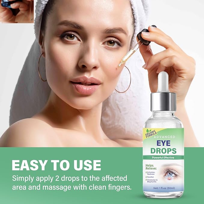 Stye Eye Treatment, Stye Eye Drops Serum for Styes Chalazion and Blepharitis, Chalazion Remover Fast Relief, Restore Healthier Eye Skin, 30ml-VivaGrace Women