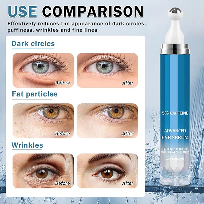 Caffeine Under Eye Cream for Dark Circles Eye Cream for Puffiness and Bags Under Eyes,Eye Roller for Puffy Eyes and Firming,Wrinkle Reducing Crema Para las Ojeras-VivaGrace Women