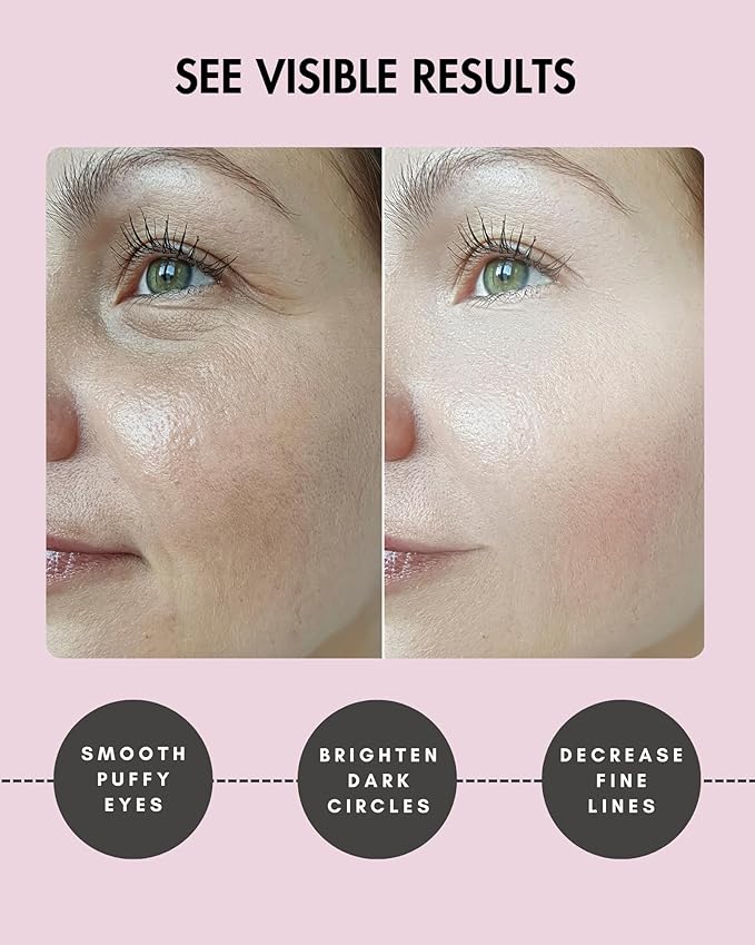 Under Eye Patches for Dark Circles and Puffiness - (15 pairs) Collagen Eye Masks with Natural Extracts for Wrinkle Reduction, Puffy Eyes & Eye Treatment Gels-VivaGrace Women