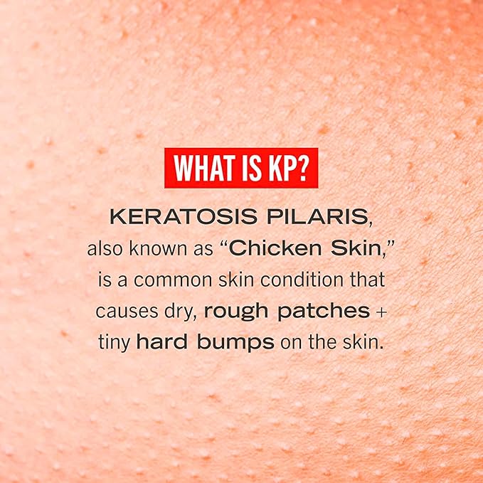 First Aid Beauty KP Bump Eraser Body Scrub Exfoliant for Keratosis Pilaris with 10% AHA – 8 oz + Bonus 1 oz Travel Size Tube-VivaGrace Women