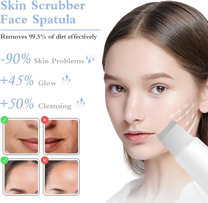 Skin Scrubber Face Spatula Skin Spatula Pore Cleaner Blackhead Remover Tools for Facial Deep Cleansing Skin Care Tool for Men and Women (White)-VivaGrace Women