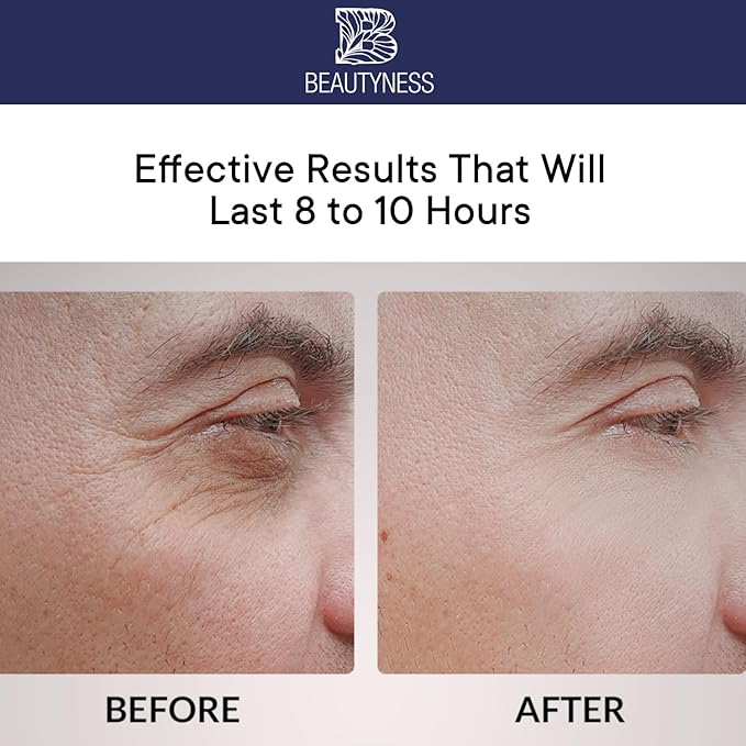 Instant Ageless Eye Cream – Anti Wrinkle Cream, Removes Under Eye Puffiness, Bags, Expression Lines, & Dark Circles. Powerfully Tighen & Lifts Sagging Skin. Disappears Before Your Eyes In Minutes.-VivaGrace Women