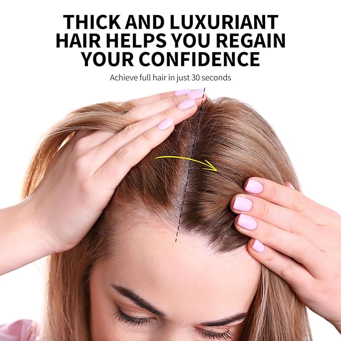 SEVICH Hair Fibers with Spray Applicator - Natural-Looking Hair Thickening Fibers for Men & Women, Instant Fullness, Wind & Water Resistant, Easy Wash Out, 25g (Dark Brown)-VivaGrace Women