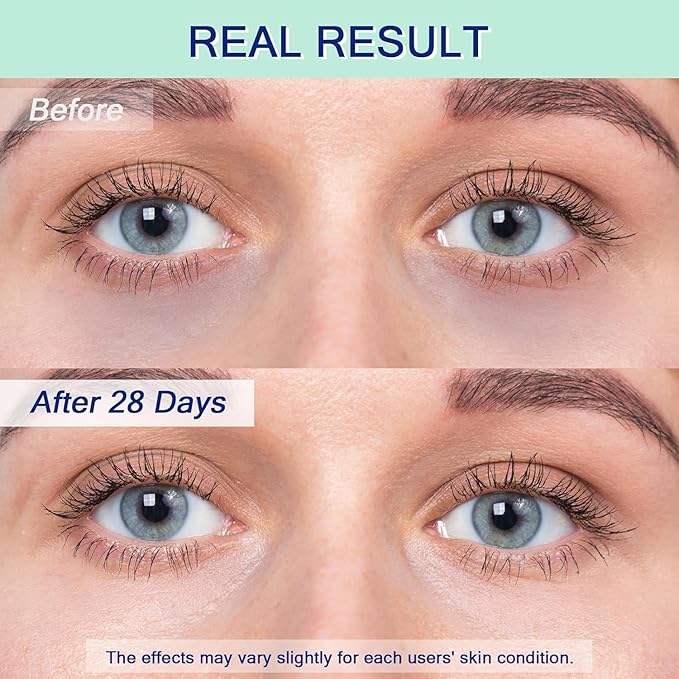 Eye Serum for Dark Circles, 5% Caffeine Under Eye Cream for Wrinkles, Morning Puffiness and Fine Lines, Deeply Repairs the Muscles Around the Eyes with 360°Massage Ball, 0.5 Fl Oz-VivaGrace Women
