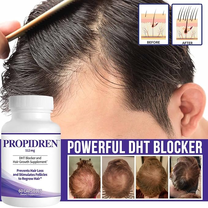 Propidren by HairGenics - DHT Blocker & Hair Growth Capsules to Prevent Hair Loss & Stimulate Hair Follicles, to Stop Hair Loss & Regrow Hair. Proprietary Anti-Hair Loss & Hair Regrowth Treatment.-VivaGrace Women