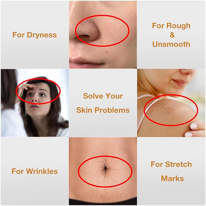 2PCS Folic Acid&Amino Acid,Essence combination of oil and lotion,Age-Defying Vegetable Glycerine for Skin Firms, Smooth, Anti Stretch Mark, Moisturizing 6.7 OZ +3.7 OZ-VivaGrace Women