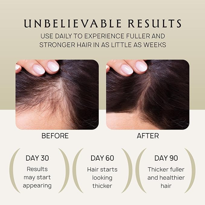 Hair Growth Oil Spray - 100% Pure Ingredients For Non Greasy, Thicker & Stronger Hair - Organic Batana, Castor, Biotin, Saw Palmetto, and Rosemary Oil for Men & Women Scalp - 4 FL OZ-VivaGrace Women