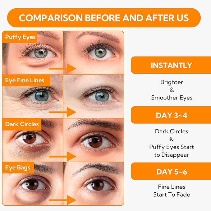 Vitamin C Under Eye Patches(30 Pairs) -Cooling Eye Masks for Dark Circles, with Caffeine Niacinamide Hydra-Gel Collagen, Puffy Eyes & Eye Bags Treatment, Fine Lines & Wrinkles Reduce, Anti-Aging-VivaGrace Women