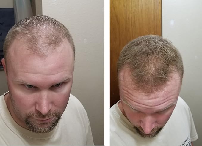 Quick Fix For Thinning Hair and Bald Spot. Get 10X Fuller Hair Instantly. All-Natural Hair Building Fiber For Hair. Trial Size (10-Day Supply). Light Brown-VivaGrace Women