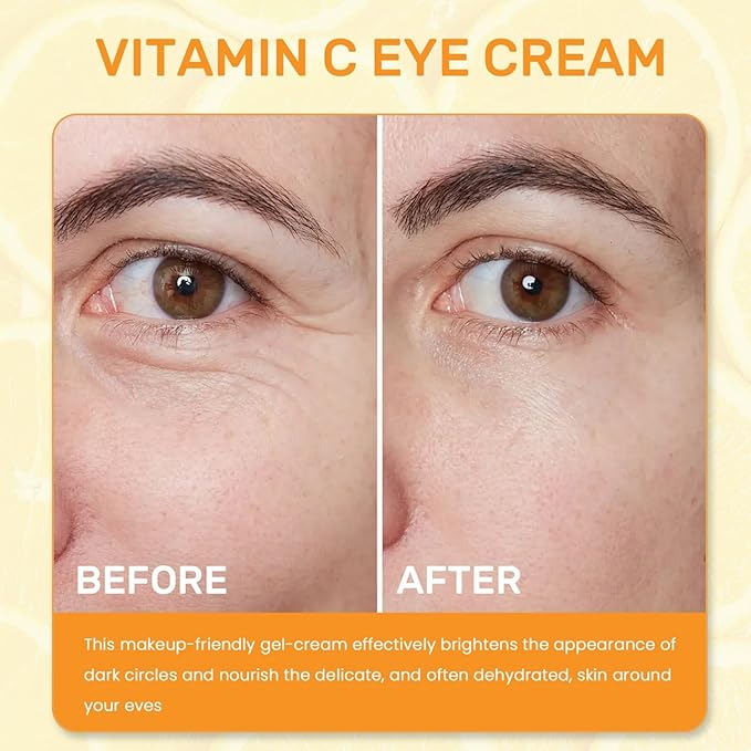 Vitamin C Eye Cream For Dark Circles, Under Eye Cream Anti Wrinkles For Reduce Puffiness And Bags Fine Lines, Wrinkles, Hydrating Eye Lifting Skin Care Anti Aging Eye Cream(0.7 FL.Oz)-VivaGrace Women