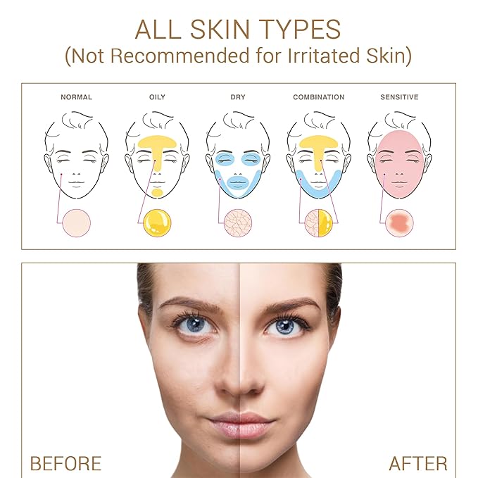 Niacinamide with Salicylic Acid Serum for Face, Hydrating Dark Spot Facial Serum & Plumb Skin, Daily Skincare Essential, 1 fl. oz, Made in Europe-VivaGrace Women