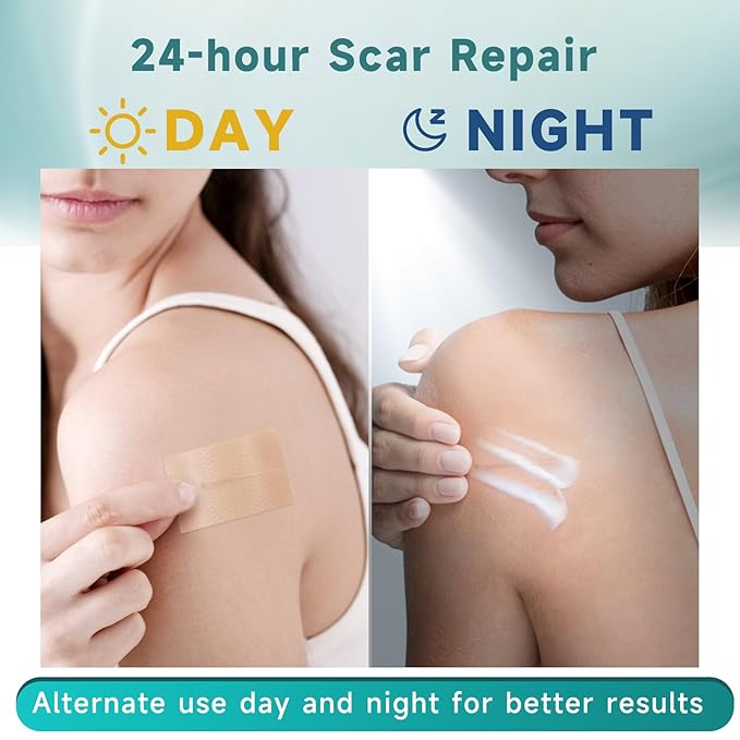 Scar Suite Bundle, Advanced Silicone Scar Cream and Scar Sheets, Advanced Scar Treatment for Surgery, Burns, and Injuries, Professional Grade Results-VivaGrace Women