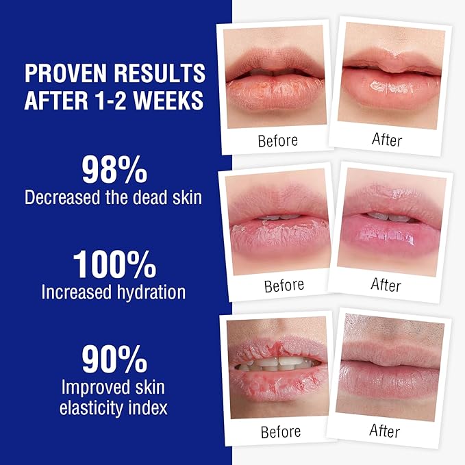 Lip Balm Treatment with Beeswax, Peppermint Oil,Natural Formula Lip Balm with Vitamin E & C Lips Daily Conditioning 24 hrs Long-lasting Moisture, Gentle Exfoliation Prevent Dryness & Chapping-VivaGrace Women