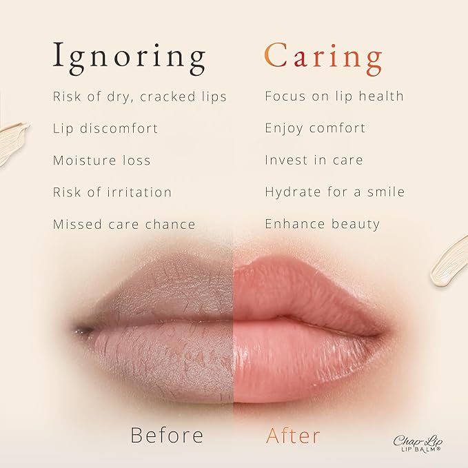 CHAP-LIP Lip Balm 60 Ct. with Fruit Flavors, Cocoa Butter, Coconut Oil | Moisturizing Vitamin E & Total Hydration Treatment & Soothing Lip Therapy (60 Ct Pack of 12)-VivaGrace Women