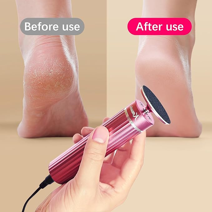 5.3'' Electric Foot Callus Remover with 80pcs Sandpaper Discs & Brush, Professional Aluminum Ergonomic Pedicure Tool, Stepless Speed & Reverse Control for Dead Skin Removal (Pink)-VivaGrace Women