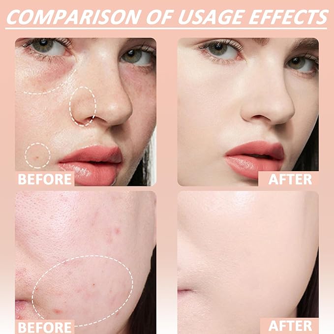 Purifying Exfoliating Gel, Purifying Enzymes Exfoliating Gel, Facial Exfoliator Cleanser, Gentle Facial Cleanser for All Skin Types