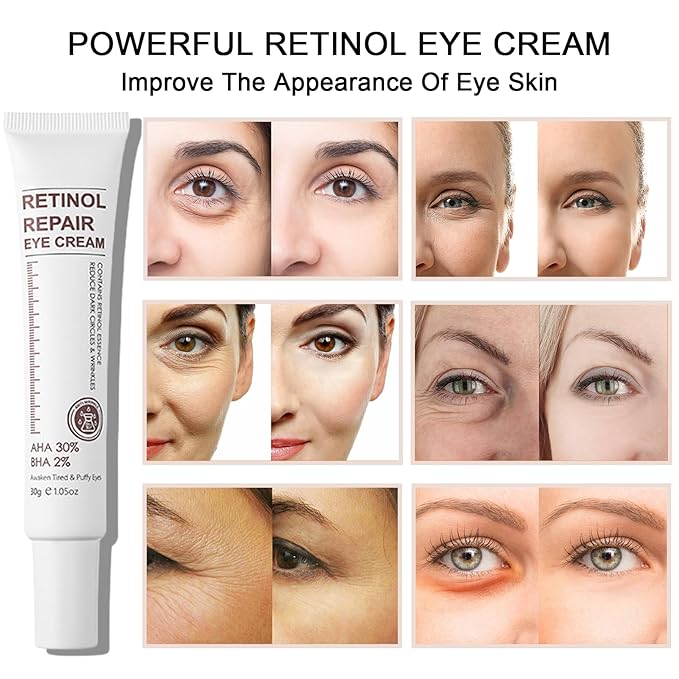 Retinol Eye Cream Anti Aging + 24k Under Eye Patches Kit, Under Eye Patches For Puffy Eyes And Dark Circles, Under Eye Cream With Retinol Serum,Dark Circle Eye Cream For Moisturizing, Firming-VivaGrace Women