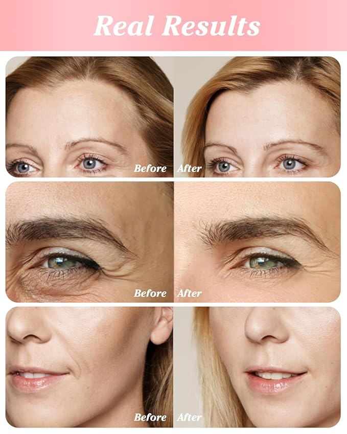 Retinol Eye Stick Under Eye Cream Anti Aging Eye Balm Reduces Fine Lines and Dark Circles-VivaGrace Women