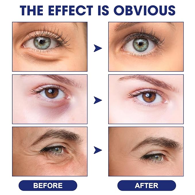 Anti Wrinkle Essence, Glozie Eye Serum, Glozie Instant Eye Lift Eye Cream, Anti Wrinkle Serum, Eye Cream For Wrinkles, Instant Anti-Aging Firm Eye Temporary Eye Tightener, Permanent Anti-Aging Cream-VivaGrace Women
