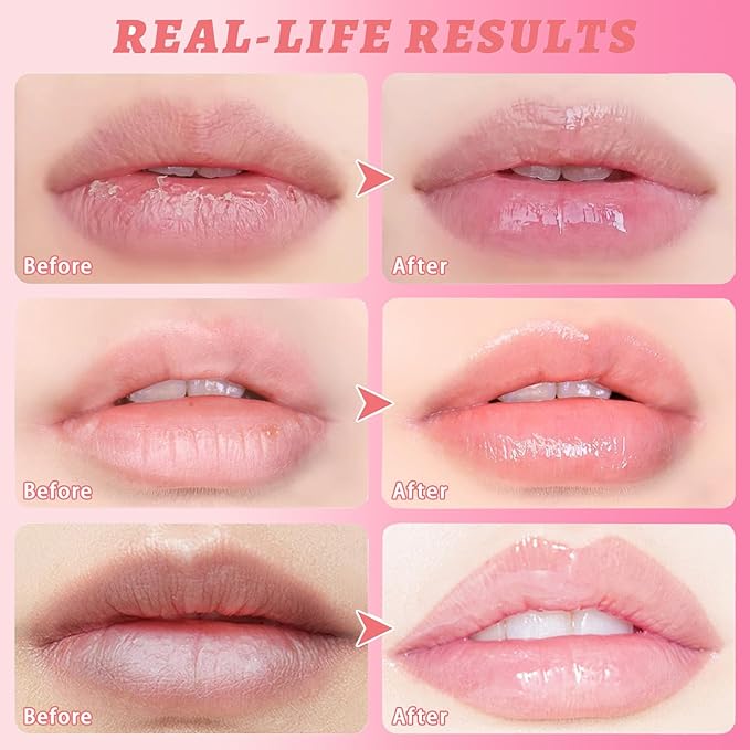 3 Pcs Honey Lip Balm, Bee Lip Balm Honey Pot,Moisturizing Lip Mask Overnight,Hydrate Repair Prevent Dry Cracked Lip Care (Honey+Strawberry+Watermelon)-VivaGrace Women