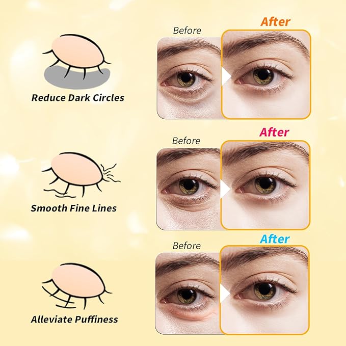 Under Eye Patches(36 Pairs), 24K Gold, Caffeine, Retinol Eye Masks for Puffy Eyes, Wrinkles, Dark Circles, Undereye Bags Treatment - Restoring & Awakening & Moisturizer Skin care Gift for Women-VivaGrace Women