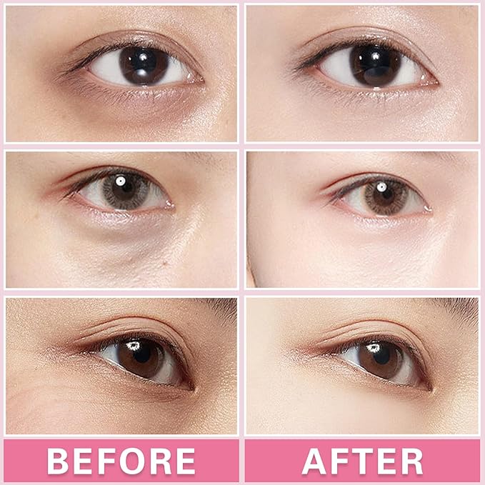 2PCS Under Eye Cream Lift Firm Skin Around the Eyes-VivaGrace Women