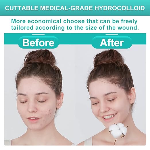 Dimora 20 Pack Hydrocolloid Wound Dressing, Ultra Thin 4" x 4" Large Patch Bandages with Self-Adhesive-VivaGrace Women