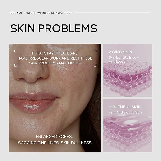 Anti Aging Skin Care Set, 1% Retinol Dark Spot Remover for Face with Face Serum & Moisturizer, Travel Size Skincare Set for Women, Reduce Wrinkles, Firm & Hydrate for All Skin Types-VivaGrace Women