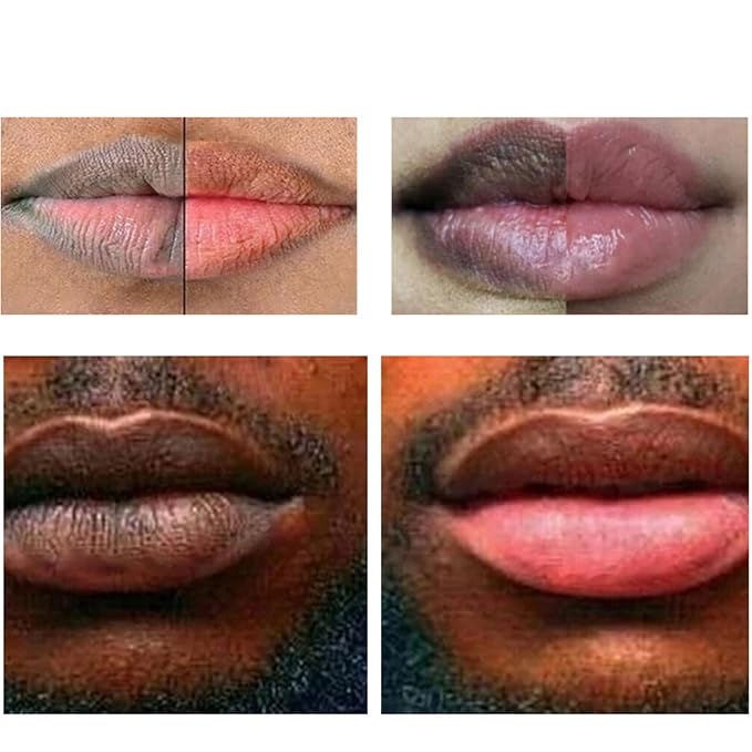 2pcs Lip Lightening for Dark Lips Lip Brightener for Smokers Dark Lip Treatment Lightening Cream for Pink Lips Lip Lightener for Smoker Lips Lip Lightening balm for Men and Women (Red)-VivaGrace Women