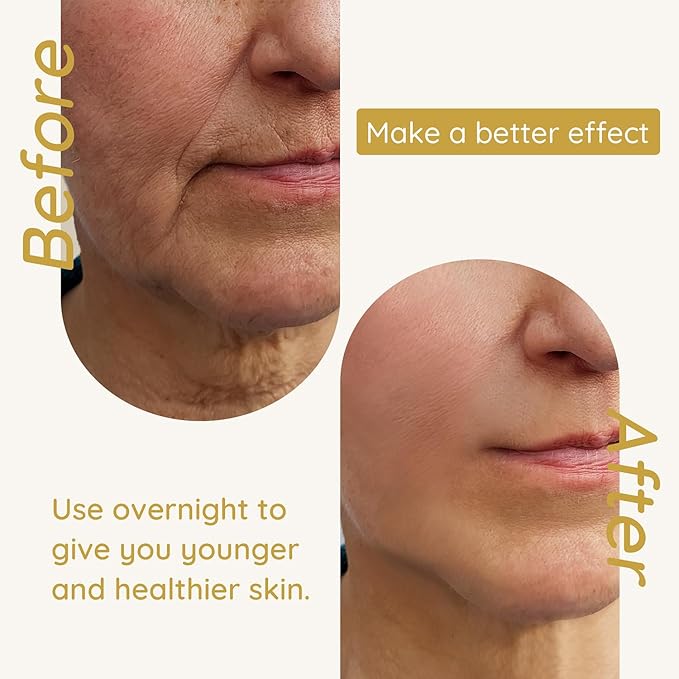 Enaskin Naturals 5 in 1 Anti Wrinkle Face Patches Anti Wrinkle Gel Face Masks (5 in 1 Pack)-VivaGrace Women