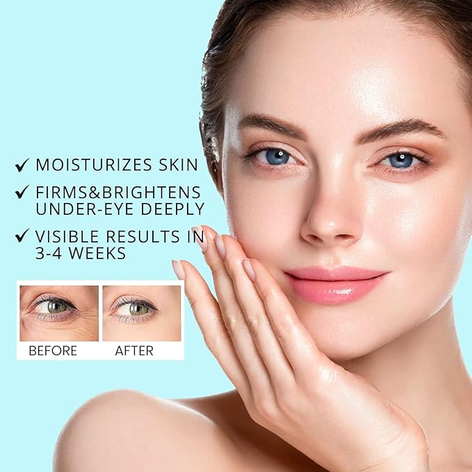 Retinol Eye Cream for Dark Circles: Unlock Radiant Eyes with Our Advanced Formula for Dark Circles, Wrinkles, and Under Eye Treatment-VivaGrace Women