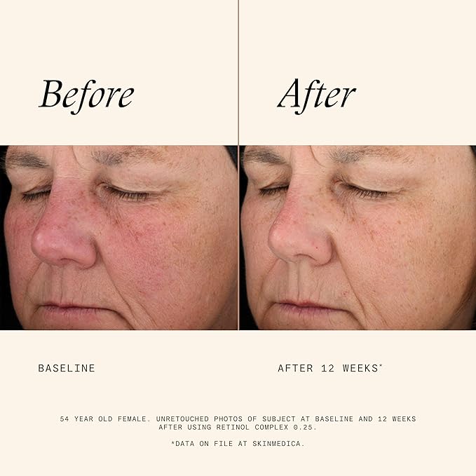 SkinMedica Retinol 0.25 Complex - Retinol Serum for Face, Age-Defying Advanced Retinol Cream That Renews Skin and Diminishes the Appearance of Fine Lines and Wrinkles, 1 Fl Oz-VivaGrace Women