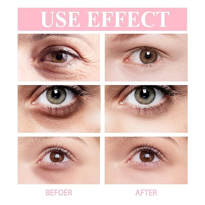 Retinol Polypeptide Eye Cream,Retinol Eye Cream for Dark Circles and Puffiness, Visible Results in 3-4 Weeks, Under Eye Cream for Anti Aging, for Puffiness and Bags to Reduce Fine Lines(2pcs)-VivaGrace Women