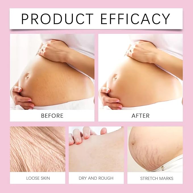 Stretch Mark Pregnancy Oil, Natural Oil Skincare Body Oil Serum for Scars and Stretch Marks, Face with Vitamin E & A for Sensitive Dry Skin and Body Moisturizer-VivaGrace Women