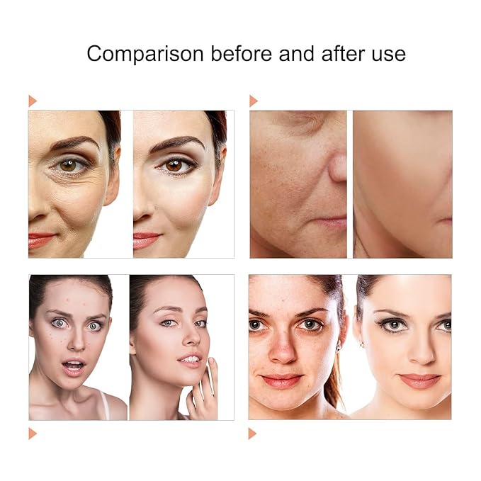 7 Color LED Face Mask LED Light Therapy Equipment for Skin Care at Home-VivaGrace Women