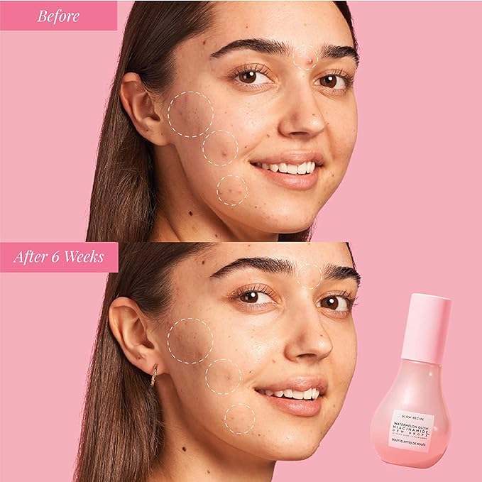 Glow Recipe Watermelon Niacinamide Dew Drops - Brightening, Plumping Hydrating Face Serum, Makeup Primer + Liquid Highlighter with Hyaluronic Acid - Dewy & Glowing Korean Skin Care (40ml)-VivaGrace Women