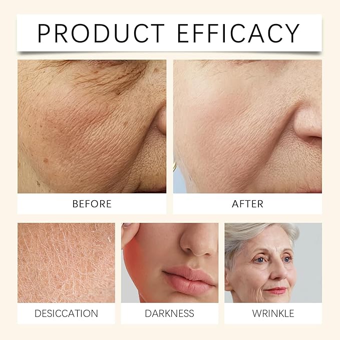 Whipped Beef Tallow and Honey Balm,Beef Tallow for Skin,Tallow Face Moisturizer,Tallow and Honey Balm,Grass Fed Grass Finished Face Cream (120G/1pcs)-VivaGrace Women