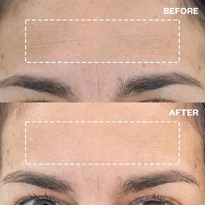 Wrinkles Schminkles Forehead Wrinkle Patches, 2-Pack, Reusable Hypoallergenic Silicone Smoothing Pads + Silicone Patch Cleanser 2 oz, Clean Silicone Patches Without Breaking Down The Adhesive-VivaGrace Women