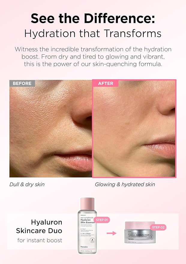 Hanskin Hyaluron Skin Essence, Hydrating Facial Astringent Toner for Dry, Dull, Sensitive Skin - Hyaluronic Acid Collagen Moisturizing Purifying Paraben-Free Korean Skincare [5.07 fl. oz.]-VivaGrace Women