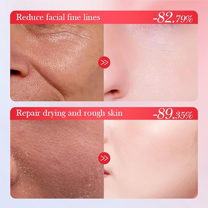 Goji Berry Skincare Sets, 6 In 1 Complete Facial Care Kit Antioxidant, Anti Aging Skin Care Set For Tighten, Lift & Reduce Wrinkles, Goji Berries Face Care Set For Women, Beauty Gift Set For Girls-VivaGrace Women