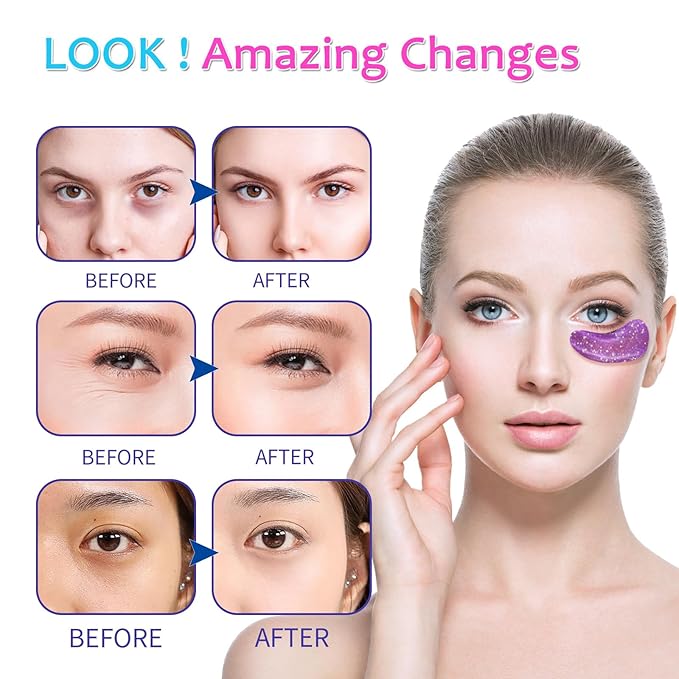 [ 28 Pairs ] Under Eye Patches, Eye Gel Mask for Puffy Eyes and Dark Circles with Natural Marine Collagen Reduce Wrinkles Anti-Aging Face Eye Skin Care Mask for Face,Puffiness, Eye Bags and Wrinkles-VivaGrace Women