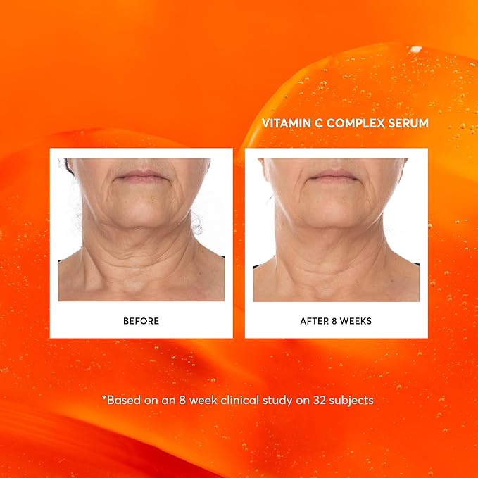 Naturium Vitamin C Complex Face Serum, Anti-Aging Facial Treatment with Hyaluronic Acid & Vitamin E, 1 oz-VivaGrace Women