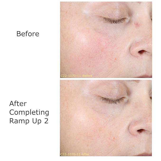 Hydrate & Soothe Beauty Collection Gift Bundle / Starter Kit, Activator with 0.05% Retinol Cream, Ramp-Up Regimen 2 & RHR Overnight Mask, Skin Care Routine, For All Skin Type-VivaGrace Women