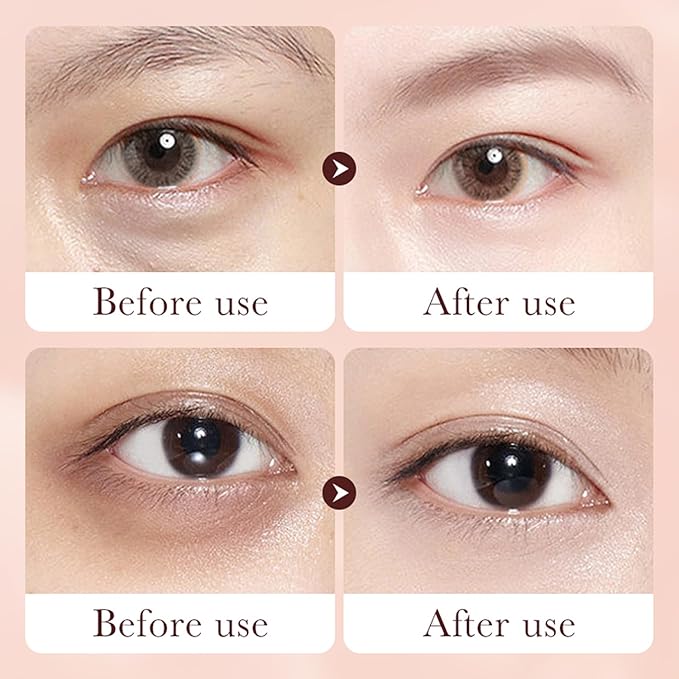 Retinol Eye Cream Stick for Dark Circles Under Eye Treatment, Puffiness and Bags - Firming & Hydrating Eye Cream for Anti-Aging Results in 3-4 Weeks-VivaGrace Women