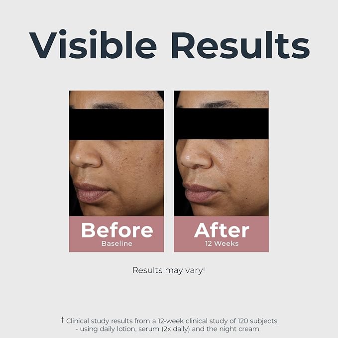 Eucerin Radiant Tone Night Cream, Dark Spot Corrector with Thiamidol, Night Moisturizer for Face Helps Visibly Reduce the Look of Persistent Dark Spots, All Skin Types, 1.7 Oz Bottle-VivaGrace Women