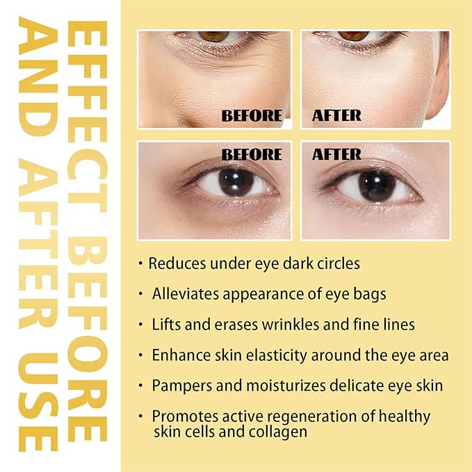 Time Eraser Rollerball Castor Oil and Frankincense, Time Eraser Rollerball, Castor Oil and Frankincense Eye Roller for Reducing Dark Circles and Bags Under Eyes-VivaGrace Women