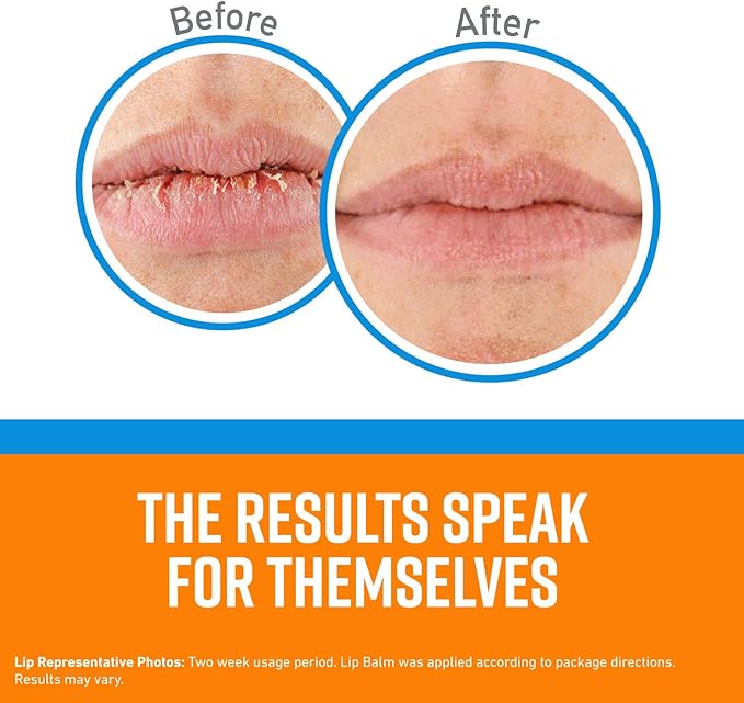 O'Keeffe's Cooling Relief Lip Repair Lip Balm for Dry, Cracked Lips, Stick, (Pack of 9)-VivaGrace Women