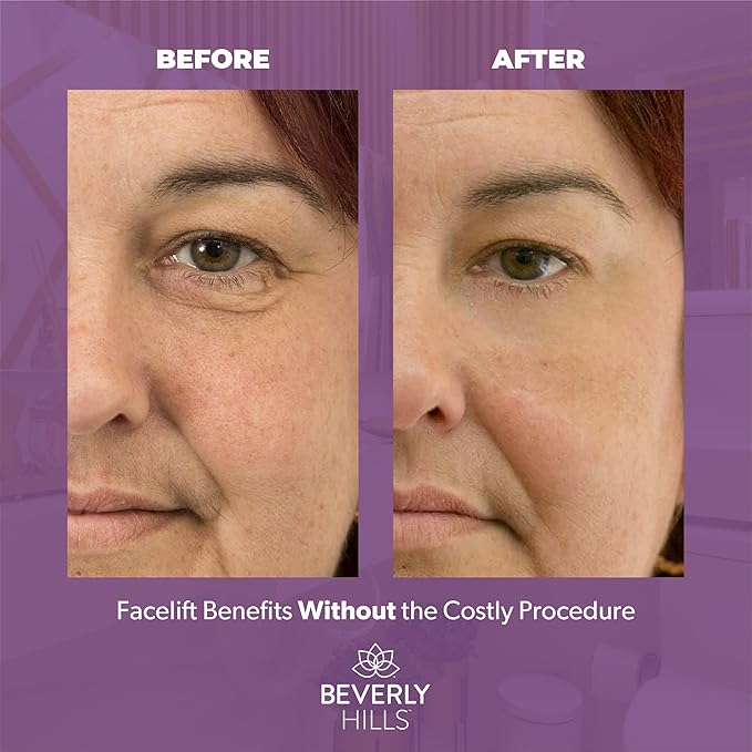 Beverly Hills V-Lift Instant Eye Lift and Eye Tuck Bee Venom Serum for Puffy Eyes, Dark Circles, Wrinkles, and Under Eye Bags Treatment for Women and Men | 30mL (120 Day Supply)-VivaGrace Women